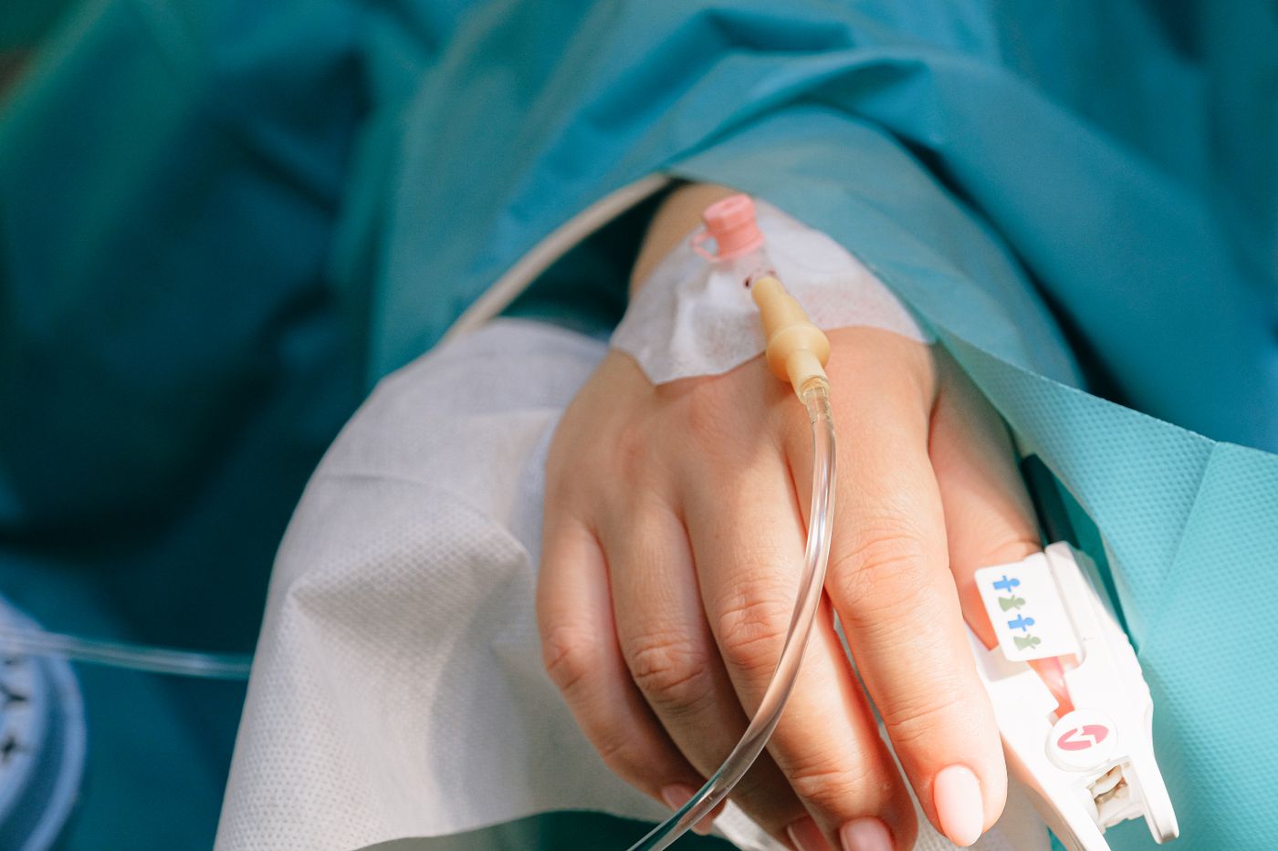 Patient’s hand with an IV catheter and pulse oximeter during outpatient surgery