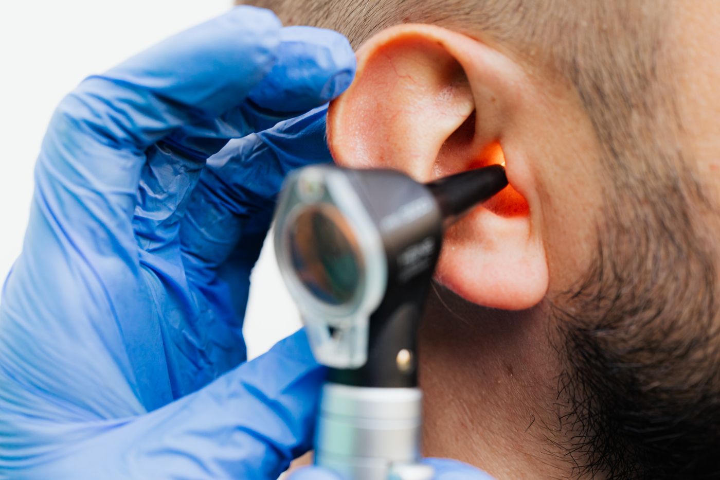 Clinician using an otoscope to examine a patient’s ear